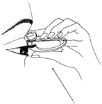 CN107404987B-patent-drawing