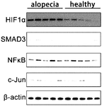 CN115089711A-patent-drawing
