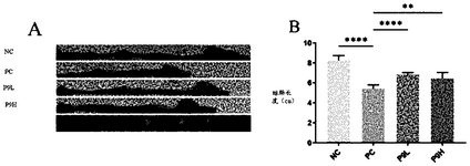 CN117064922A-patent-drawing