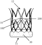 CN212415992U-patent-drawing