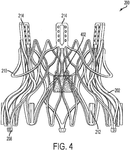 EP3581151A1-patent-drawing