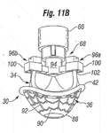 EP3842012A1-patent-drawing