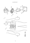 ES2837390T3-patent-drawing
