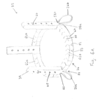 GB2574576A-patent-drawing