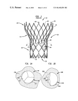 US10143551B2-patent-drawing