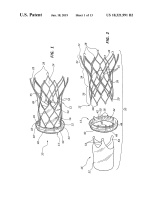 US10321991B2-patent-drawing