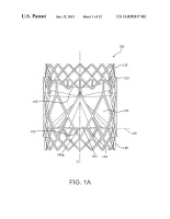 US11039917B2-patent-drawing