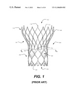 US11166816B2-patent-drawing