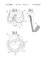 US11266497B2-patent-drawing