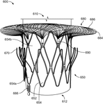 US11364117B2-patent-drawing