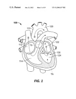 US11364117B2-patent-drawing