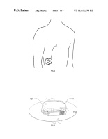 US11412994B2-patent-drawing