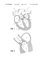 US11471275B2-patent-drawing