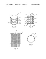 US11607311B2-patent-drawing