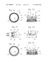 US11690714B2-patent-drawing