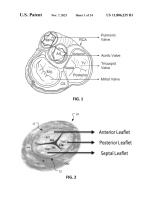 US11806235B1-patent-drawing