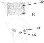 US12268594B2-patent-drawing