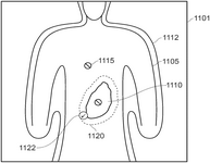 US12290938B2-patent-drawing