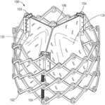 US12343253B2-patent-drawing