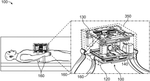 US12357376B2-patent-drawing