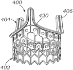 US12357455B2-patent-drawing