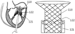 US12357458B2-patent-drawing