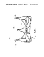 US20140214158A1-patent-drawing