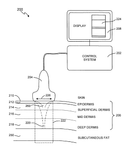 US2014148834A1-patent-drawing