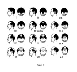 US2015150771A1-patent-drawing