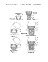 US20160279297A1-patent-drawing