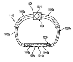 US2016045312A1-patent-drawing