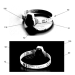 US20170014035A1-patent-drawing