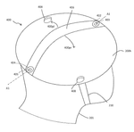 US2017340897A1-patent-drawing