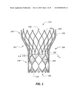 US20180042555A1-patent-drawing