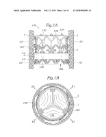 US20180042690A1-patent-drawing