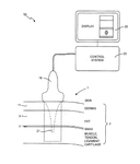 US2018126192A1-patent-drawing