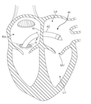 US2019254816A1-patent-drawing