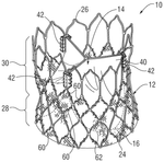 US2019380830A1-patent-drawing