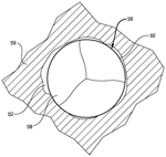 US2020008939A1-patent-drawing
