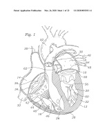 US20200093593A1-patent-drawing