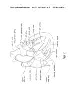 US20200268316A1-patent-drawing