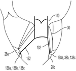 US2020085576A1-patent-drawing