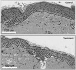 US2020215116A1-patent-drawing