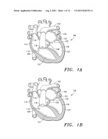 US20210236278A1-patent-drawing