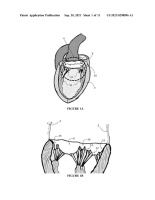 US20210298896A1-patent-drawing