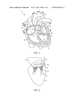 US20210346153A1-patent-drawing