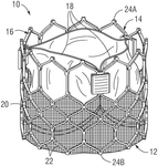US2021361417A1-patent-drawing