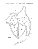 US20220079757A1-patent-drawing