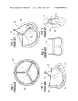 US20220183832A1-patent-drawing