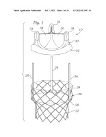 US20220211497A1-patent-drawing